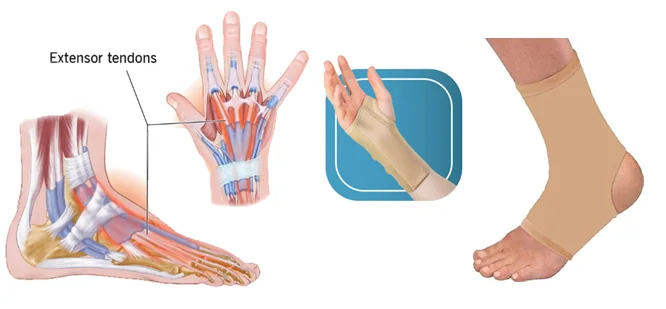 Tendonitis and tendinosis affected areas