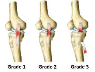Joint support and alignment visual