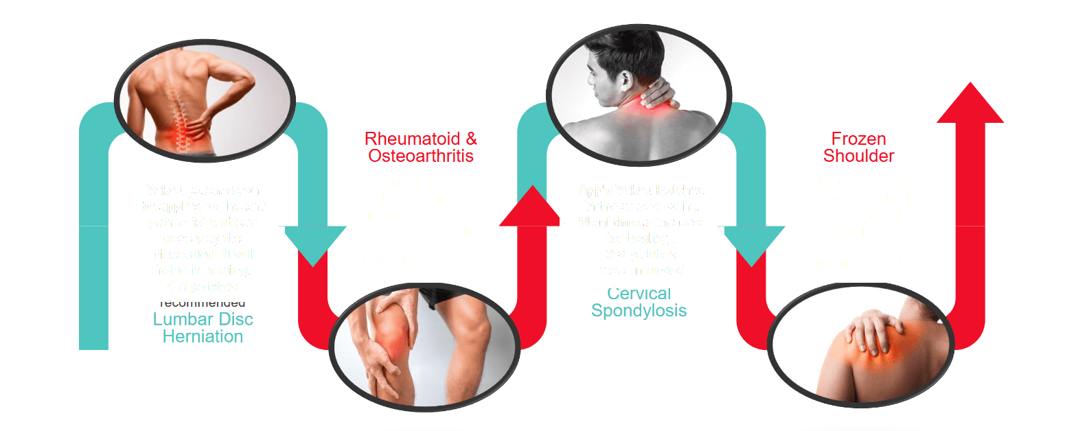 Significant pain relief result